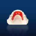 Types of Removable Orthodontic Appliances